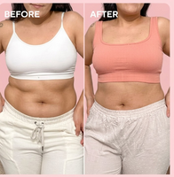 massaggiatore anti-cellulite